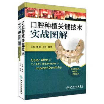 口腔种植关键技术实战图解