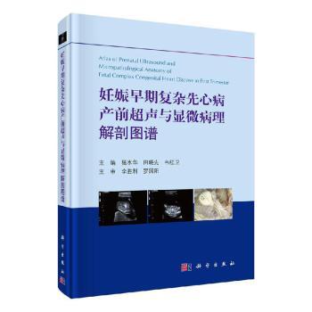 妊娠早期复杂先心病产前超声与显微病理解剖图谱