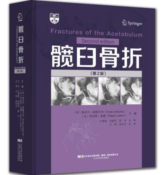 髋臼骨折+2