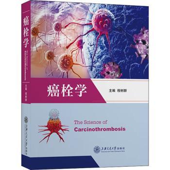 癌栓学(精)
