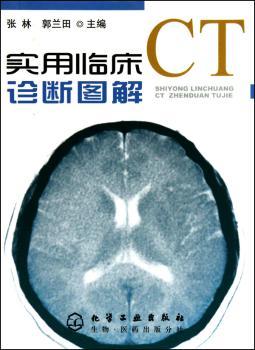 实用临床CT诊断图解