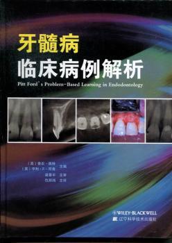 牙髓病临床病例解析