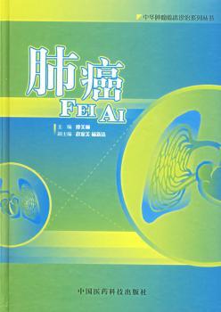 肺癌(精)/中华肿瘤临床诊治系列丛书