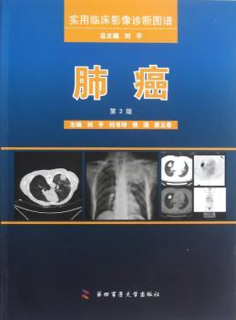 肺癌-实用临床影像诊断图谱-第2版