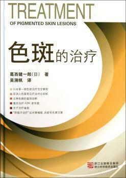 色斑的治疗