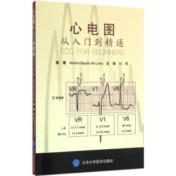 心电图从入门到精通