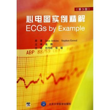 心电图实例精解