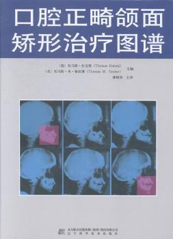 口腔正畸颌面矫形治疗图谱