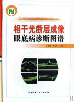 相干光断层成像眼底病诊断图谱