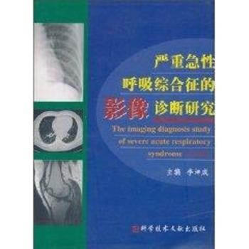 严重急性呼吸综合征的影像诊断研究
