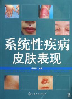 系统性疾病皮肤表现