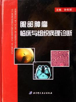 眼部肿瘤临床与组织病理诊断(精装)